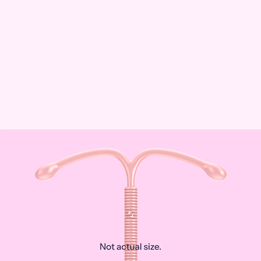 IUD birth control